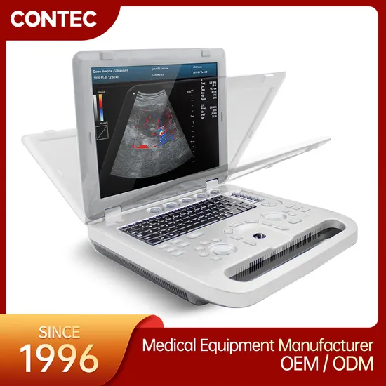 Contec Cms1700A Medical Color Doppler 3D 4D Portable Ultrasound Scanner Machine