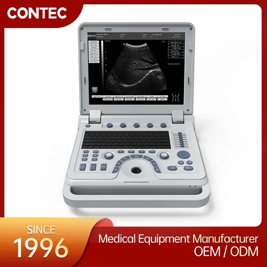 Contec Hospital Equipment Color Doppler Ultrasound Diagnostic System