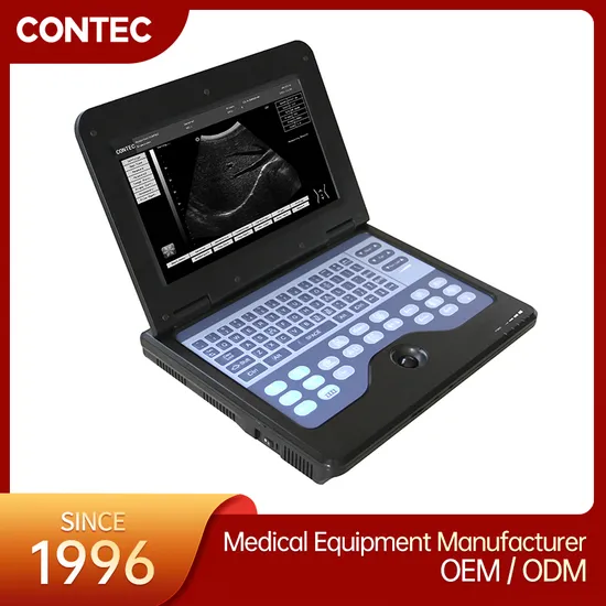 Contec Medical Equipment Cms600p2 Portable Digital Ultrasound Scanner Machine