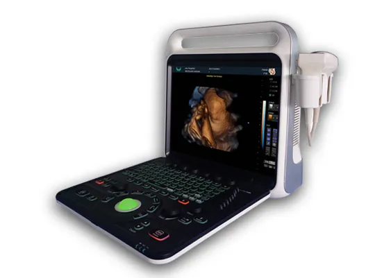Full Digital Diagnostic Ultrasound Machine Echo Phased Probe Color Doppler Ultrasound Scanner