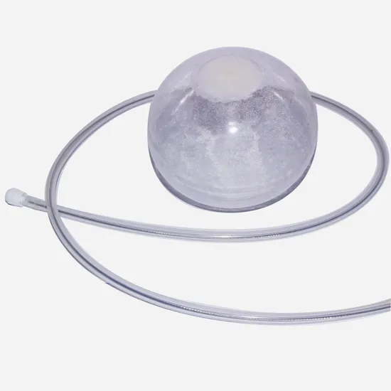 Minimally Invasive Bariatric Treatment Intragastric Balloon for Weight Loss