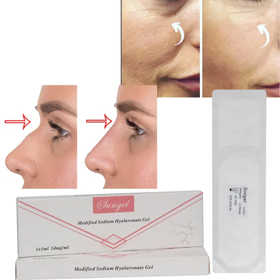 Cosmetics Skin Care Injectons Lip Plumper Filler Injection Hyaluronic Acid Derma Filler for Nose Chin Lip with CE ISO
