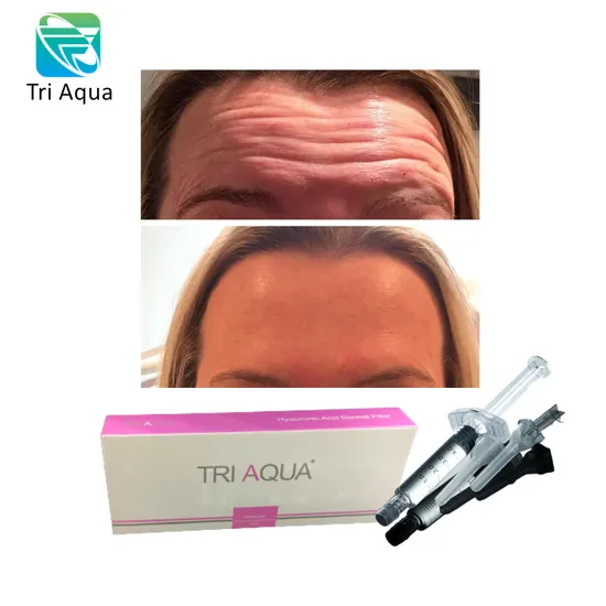 Hyaluronic Acid Injections Dermal Fillers for Forehead Lines (Best Wrinkle Filler)