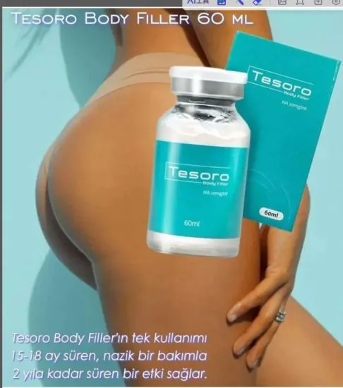 Long Lasting Tesoro 60cc for Body Ha Filler Cross Linked Hyaluronic Acid Dtesoro 60cc Injectable Filler Breast Injection Price Breast Buttock Enlargement