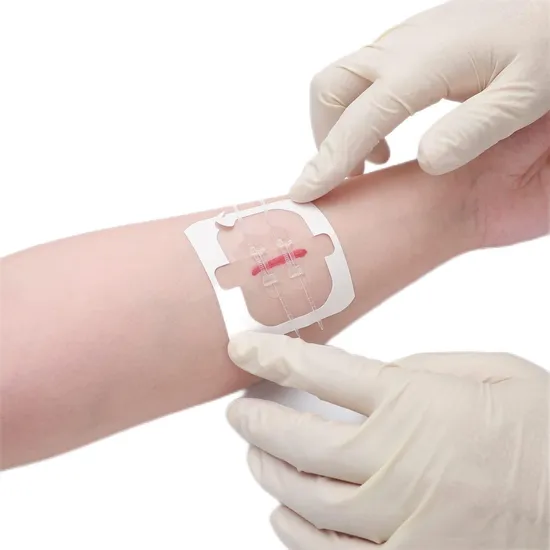 Zip Stitch Sutures Butterfly Bandaids Emergency Zipstitch Wound Closure Device