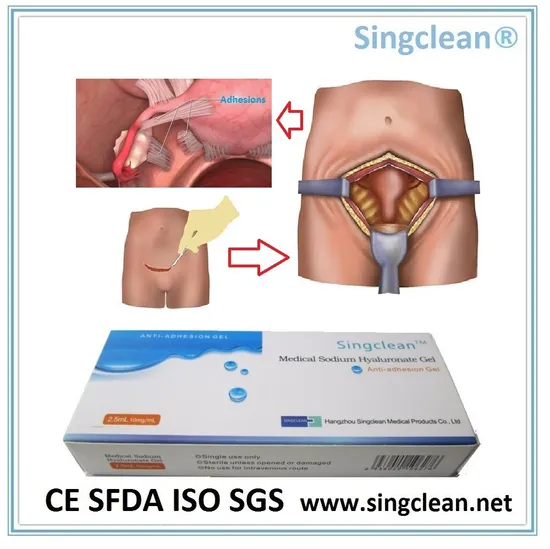 Hyaluronic Acid Sodium Hyaluronate Liquid for Anti-Adhesion