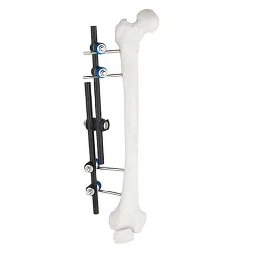 Ao Design Combination Straight Type External Fixator for Femur&Tibia