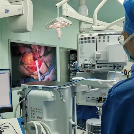 Dental 8MP Camera for Shadowless Lamp Environment