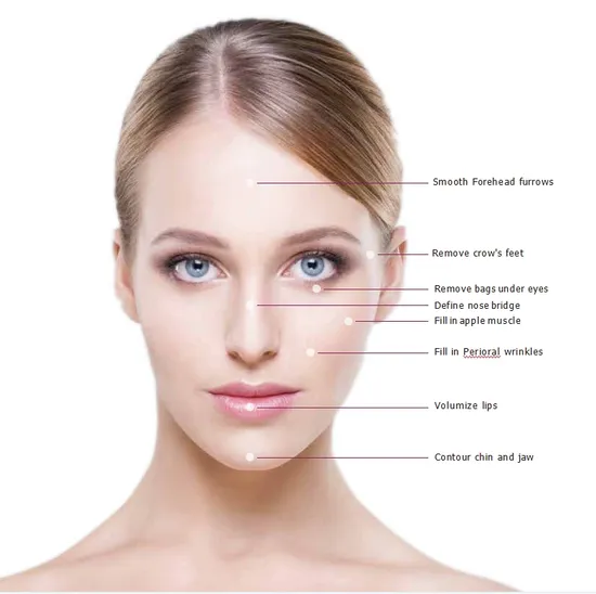 OEM Support Cross Link Hyaluronic Acid Dermal Filler