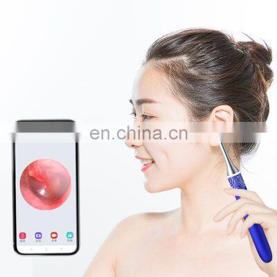 Amazon Hot Ear Clean Device Ear Scoop Wax Removal Tool Smart Pen Ear Camera Otoscope