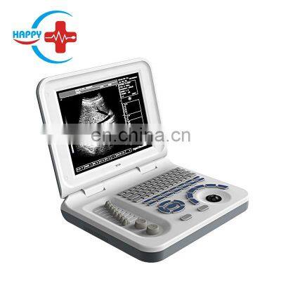 Full digital USB ultrasound Laptop PC system