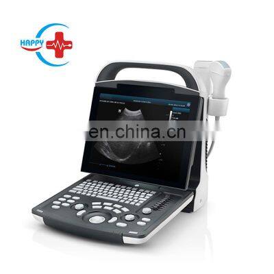 Original Mindray dp 20 ultrasound portable digital ultrasound system with super PW Doppler image