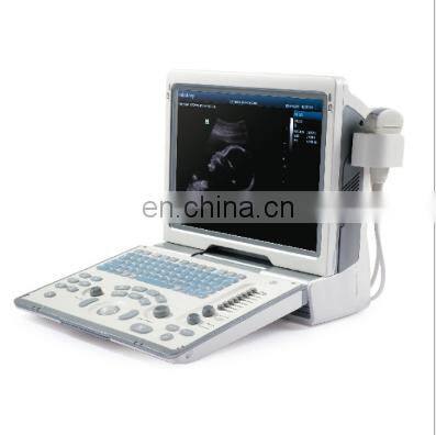 Original Mindray DP-50 ultrasound portable ultrasonic diagnosis system with 15 inch LCD monitor