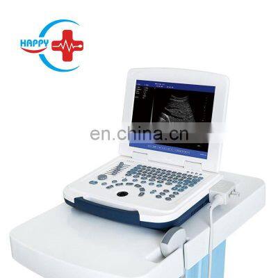 HC-A003 Cheap Full digital portable laptop ultrasound scanner