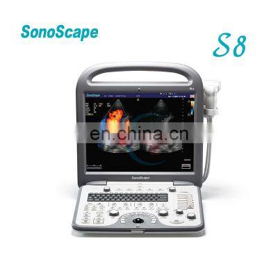 Sonoscape S8 portable color doppler ultrasound scanner sonoscape ultrasound machine S8