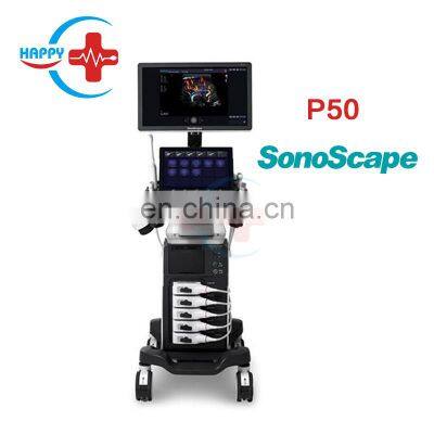 High-end color Ultrasound color doppler /Color ultrasound /P50 sonoscape for human