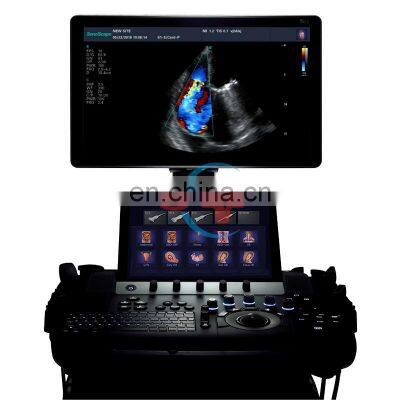 High Resolution Image System Trolley Ultrasound Machine Color Doppler 3D 4D Ultrasound Scanner Sonoscape S50
