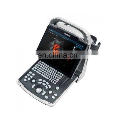 Good Quality Original Mindray DP-30 BW Portable Full digital ultrasound device Mindray DP 30 ultrasound machine