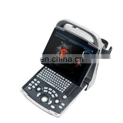Good Quality Original Mindray DP-30 BW Portable Full digital ultrasound machine Mindray DP 30 ultrasound machine