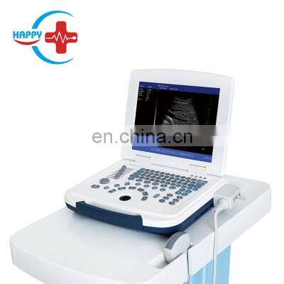 HC-A003 Cheap Full digital laptop veterinary ultrasound scanner machine