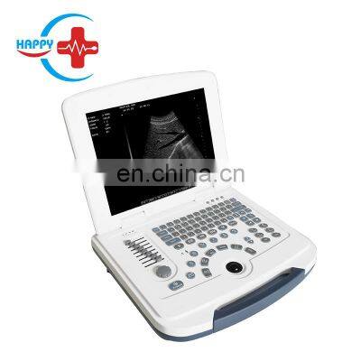 HC-A003 cheap portable ultrasound scanner price with 12 inch HD LCD display