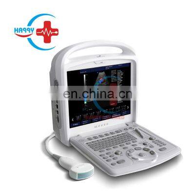 HC-A055 Medical human or veterinary use 15 inch LCD Medical monitor portable Fully digital doppler system ultrasound scanner