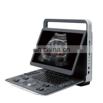 Cheapest Ultrasound scanner machine doppler Original Sonoscape ultrasound e2 /E2 model portable ultrasound machine