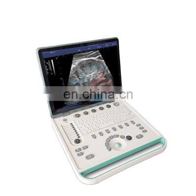 HC-A006A Cheap Laptop portable ultrasound scanner 3d 15 inch LED ultrasound scanner medical equipment B/W
