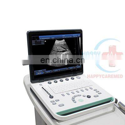 HC-A006A hot sale 3 D ultrasound hospital medical instrument 15 inch PC based Laptop ultrasound B scanner