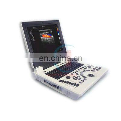 HC-A013C cheap price portable Color Doppler Ultrasound System 3D Ultrasound Machine