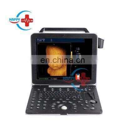 HC-A012F Ultrasound Scanner The Most Economical Portable Color Doppler Ultrasound Scanner color doppler ultrasound machine