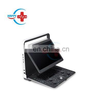 sonoscape e1 Hot sales black white sonoscape ultrasound scanner/Ultrasound Scanner Machine Portable