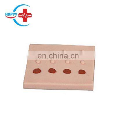 HC-S542 Dermatology teaching skin lesion pad skin disease surgery teaching model